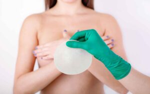 Pose d’implants mammaires : tout ce qu’il faut savoir avant de se lancer