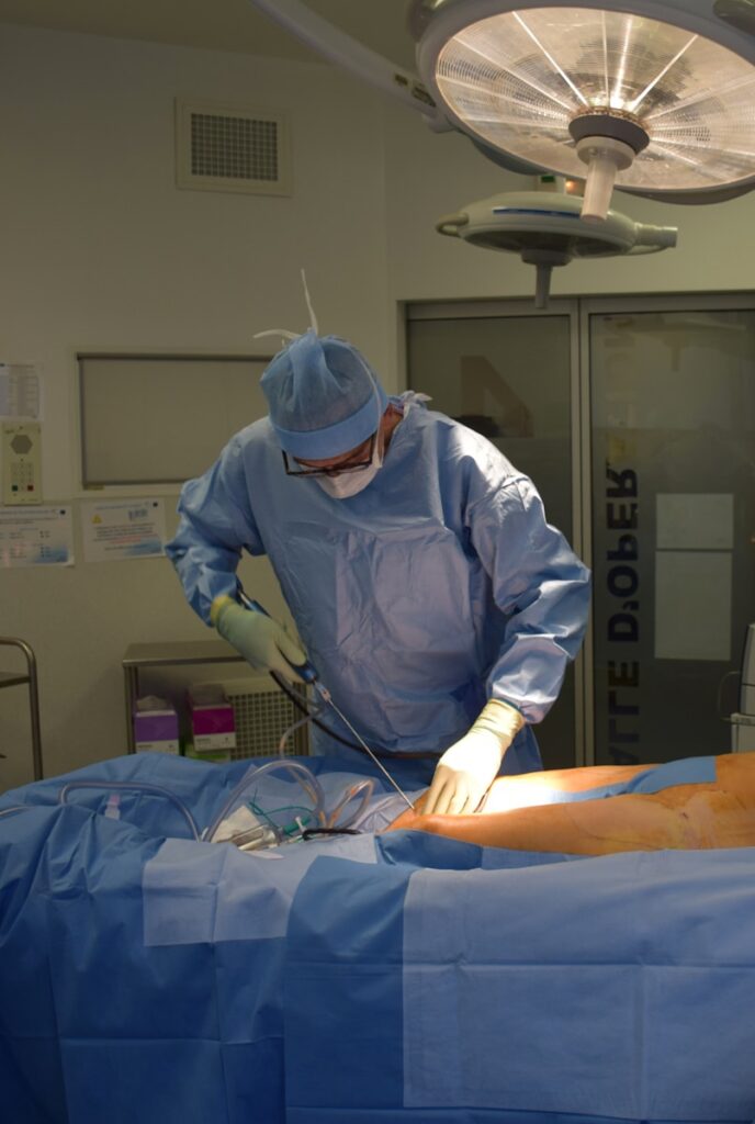 Le prix de la liposuccion : comprendre les coûts sans se tromper 2 Le prix de la liposuccion : comprendre les coûts sans se tromper